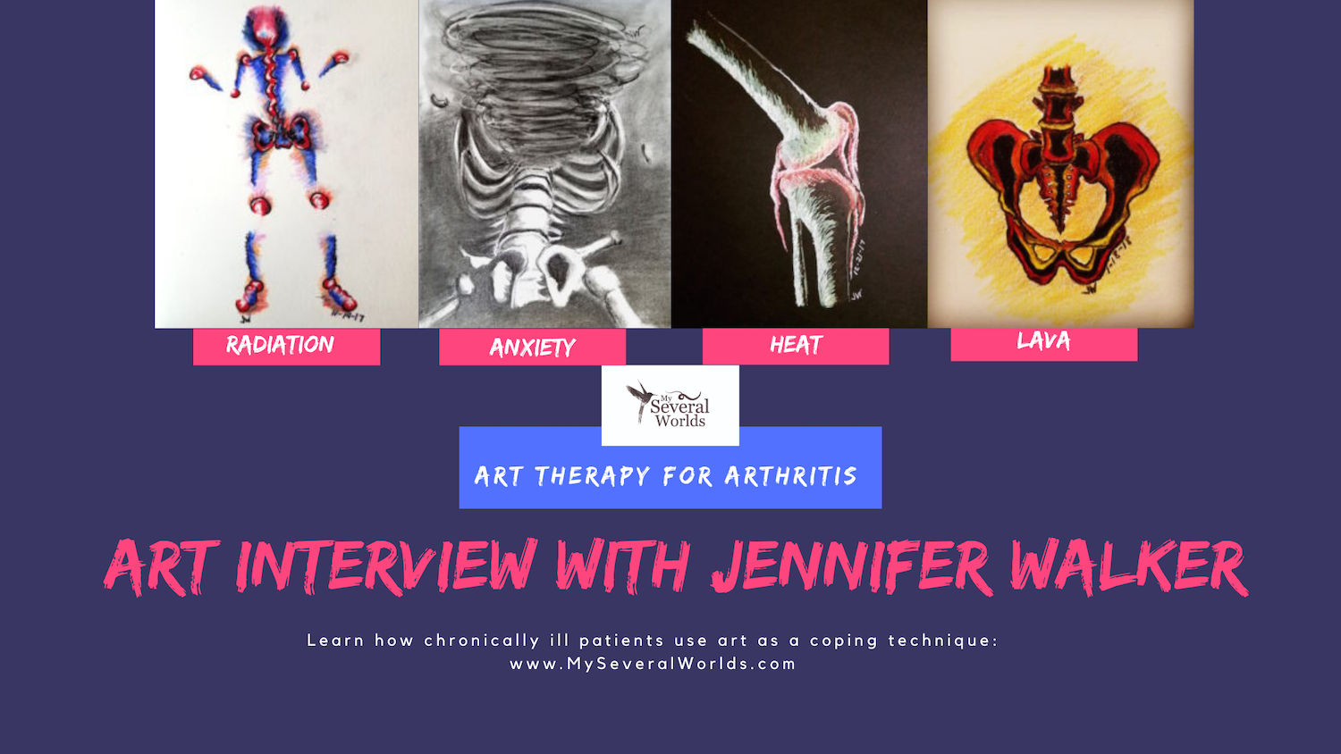 Art for Arthritis Interview