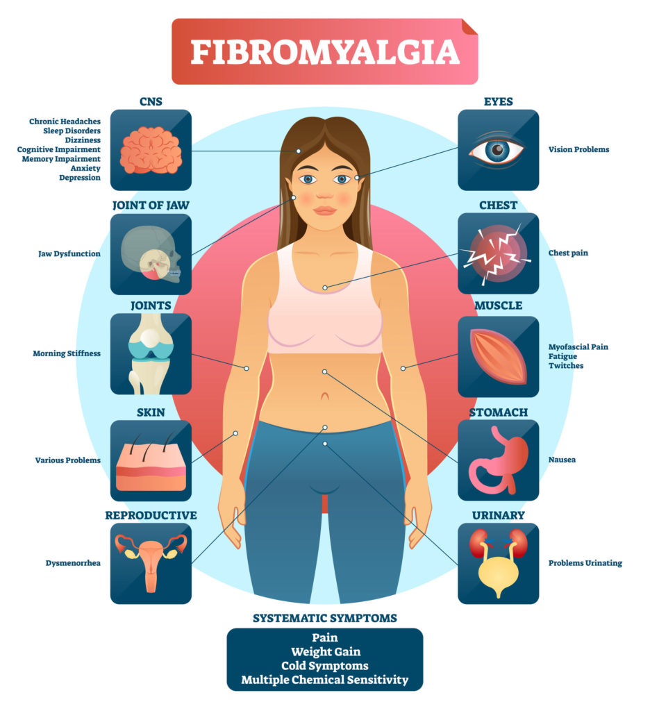 Symptoms of Fibromyalgia by Open Medicine Foundation